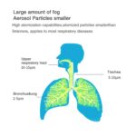 Mini Mesh Nebulizer+Battery 2p - Image 4